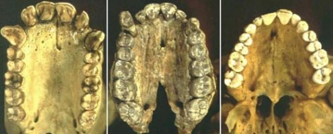 Comparativa tra la dentición de un chimpancé, Australopithecus afarensis y Homo sapiens. Fuente