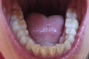  Yo no tengo el tercer molar. Foto: Mireia Querol Rovira